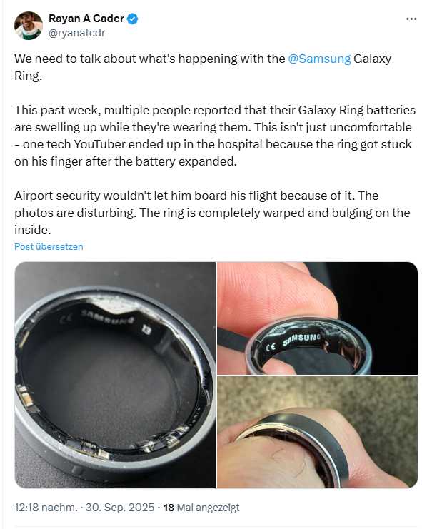 Samsung Ring battery issues